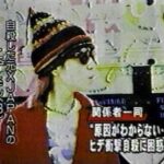 Hideの死因(真実)はガセ?弟は”事故死”。すっぴんと肥満時代の素顔