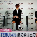 TERUの顔面やけど事件。原因は蕎麦麺の袋！のり弁/生姜焼きの料理おじさん[画像]